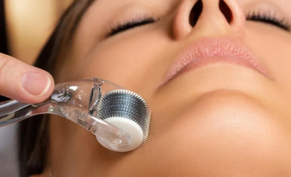 Microneedling Behandlung der Gesichtshaut